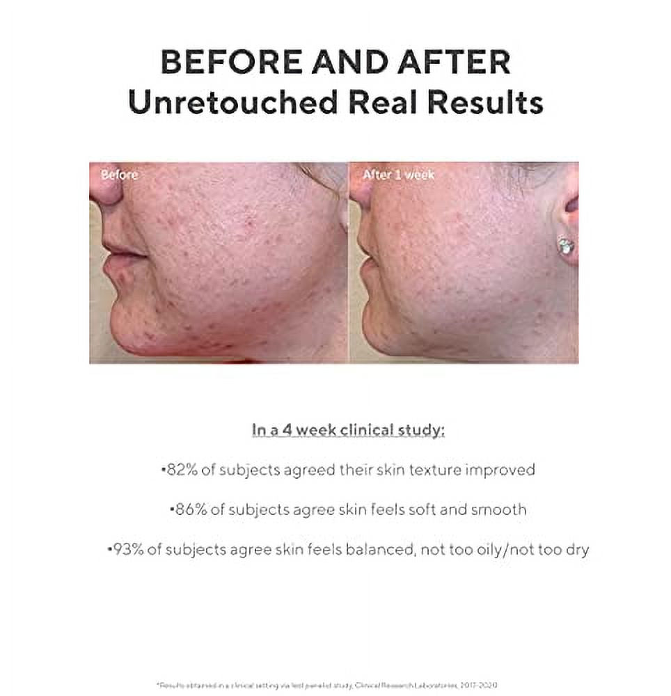 Daily Clarifying Peel Exfoliating Peel Solution Resurfacing Retinoid AHA BHA Liquid Skin-Smoothing Retinoid Salicylic Acid Glycolic Acid Peel for Face 3.2 Fl Oz I328049