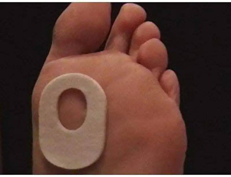 Felt Pedi-Pads 4 Pack of 100 Q120094